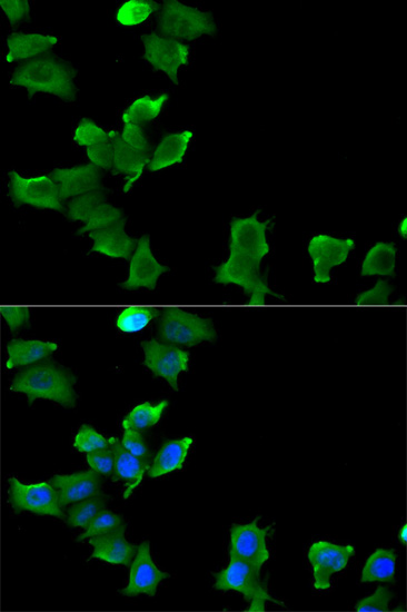 MCF7 cell; 4% Paraformaldehyde-fixed; Triton X-100 at room temperature for 20 min; Blocking buffer (normal goat serum, C-0005) at 37°C for 20 min; Antibody incubation with (GLUL) polyclonal Antibody, Unconjugated (bs-55085R) 1:100, 90 minutes at 37°C; followed by a conjugated Goat Anti-Rabbit IgG antibody at 37°C for 90 minutes, DAPI (blue, C02-04002) was used to stain the cell nuclei.