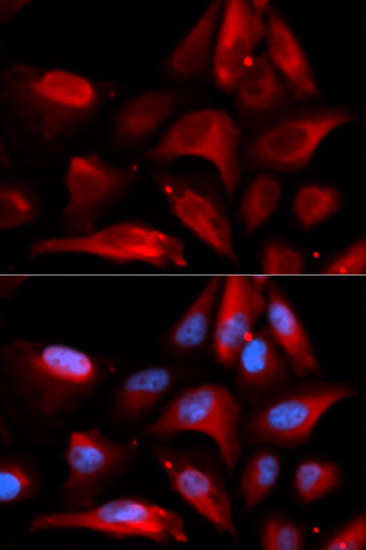 U2-OS cell; 4% Paraformaldehyde-fixed; Triton X-100 at room temperature for 20 min; Blocking buffer (normal goat serum, C-0005) at 37°C for 20 min; Antibody incubation with (S100A11) polyclonal Antibody, Unconjugated (bs-55189R) 1:100, 90 minutes at 37°C; followed by a conjugated Goat Anti-Rabbit IgG antibody at 37°C for 90 minutes, DAPI (blue, C02-04002) was used to stain the cell nuclei.