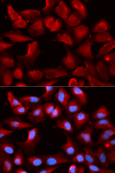 U2-OS cell; 4% Paraformaldehyde-fixed; Triton X-100 at room temperature for 20 min; Blocking buffer (normal goat serum, C-0005) at 37°C for 20 min; Antibody incubation with (DNAJB1) polyclonal Antibody, Unconjugated (bs-55055R) 1:100, 90 minutes at 37°C; followed by a conjugated Goat Anti-Rabbit IgG antibody at 37°C for 90 minutes, DAPI (blue, C02-04002) was used to stain the cell nuclei.