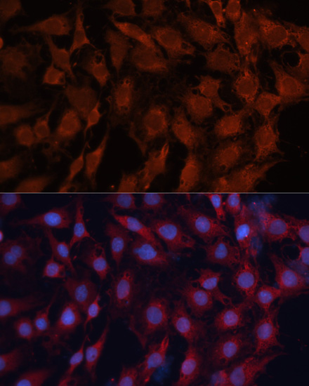 C6 cell; 4% Paraformaldehyde-fixed; Triton X-100 at room temperature for 20 min; Blocking buffer (normal goat serum, C-0005) at 37°C for 20 min; Antibody incubation with (DNAJB1) polyclonal Antibody, Unconjugated (bs-55055R) 1:100, 90 minutes at 37°C; followed by a conjugated Goat Anti-Rabbit IgG antibody at 37°C for 90 minutes, DAPI (blue, C02-04002) was used to stain the cell nuclei.