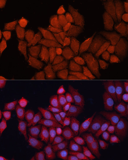 Hela cell; 4% Paraformaldehyde-fixed; Triton X-100 at room temperature for 20 min; Blocking buffer (normal goat serum, C-0005) at 37°C for 20 min; Antibody incubation with (DNAJB1) polyclonal Antibody, Unconjugated (bs-55055R) 1:100, 90 minutes at 37°C; followed by a conjugated Goat Anti-Rabbit IgG antibody at 37°C for 90 minutes, DAPI (blue, C02-04002) was used to stain the cell nuclei.