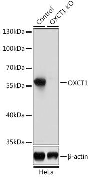 Lane 1: Hela cell lysates; Lane 2: OXCT1 knockout (KO) HeLa cell lysates probed with OXCT1 Polyclonal Antibody, Unconjugated (bs-55159R) at 1:1000 dilution and 4˚C overnight incubation. Followed by conjugated secondary antibody incubation at 1:20000 for 60 min at 37˚C.