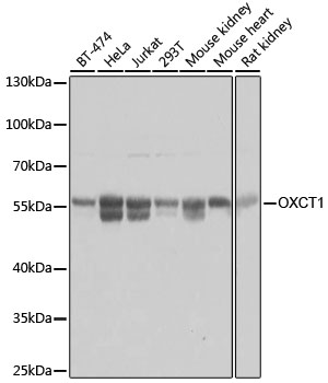 Lane 1: BT-474 cell lysates; Lane 2: Hela cell lysates; Lane 3: Jurkat cell lysates; Lane 4: 293T cell lysates; Lane 5: Mouse Kidney lysates; Lane 6: Mouse Heart lysates; Lane 7: Rat Kidney lysates probed with OXCT1 Polyclonal Antibody, Unconjugated (bs-55159R) at 1:1000 dilution and 4˚C overnight incubation. Followed by conjugated secondary antibody incubation at 1:20000 for 60 min at 37˚C.