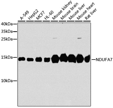 Lane 1: A549 cell lysates; Lane 2: HepG2 cell lysates; Lane 3: MCF-7 cell lysates; Lane 4: HL-60 cell lysates; Lane 5: Mouse Kidney lysates; Lane 6: Mouse Brain lysates; Lane 7: Mouse Liver lysates; Lane 8: Mouse Heart lysates; Lane 9: Rat Liver lysates probed with NDUFA7 Polyclonal Antibody, Unconjugated (bs-55144R) at 1:1000 dilution and 4˚C overnight incubation. Followed by conjugated secondary antibody incubation at 1:20000 for 60 min at 37˚C.