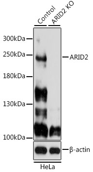 Lane 1: Hela cell lysates; Lane 2: ARID2 knockout (KO) HeLa cell lysates probed with ARID2 Polyclonal Antibody, Unconjugated (bs-55015R) at 1:1000 dilution and 4˚C overnight incubation. Followed by conjugated secondary antibody incubation at 1:20000 for 60 min at 37˚C.