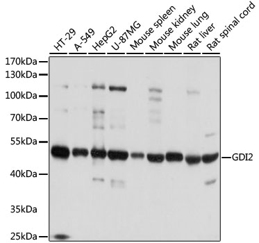 Lane 1: HT-29 cell lysates; Lane 2: A549 cell lysates; Lane 3: HepG2 cell lysates; Lane 4: U87MG cell lysates; Lane 5: Mouse spleen lysates; Lane 6: Mouse kidney lysates; Lane 7: Mouse lung lysates; Lane 8: Rat liver lysates; Lane 9: Rat spinal cord lysates probed with GDI2 Polyclonal Antibody, Unconjugated (bs-55083R) at 1:1000 dilution and 4˚C overnight incubation. Followed by conjugated secondary antibody incubation at 1:20000 for 60 min at 37˚C.