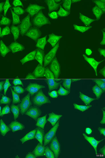 U2-OS cell; 4% Paraformaldehyde-fixed; Triton X-100 at room temperature for 20 min; Blocking buffer (normal goat serum, C-0005) at 37°C for 20 min; Antibody incubation with (Eif2ak2 ) polyclonal Antibody, Unconjugated (bs-55064R) 1:100, 90 minutes at 37°C; followed by a conjugated Goat Anti-Rabbit IgG antibody at 37°C for 90 minutes, DAPI (blue, C02-04002) was used to stain the cell nuclei.