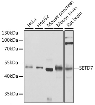 Lane 1: Hela cell lysates; Lane 2: HepG2 cell lysates; Lane 3: Mouse pancreas lysates; Lane 4: Mouse brain lysates; Lane 5: Rat brain lysates probed with SETD7 Polyclonal Antibody, Unconjugated (bs-55196R) at 1:1000 dilution and 4˚C overnight incubation. Followed by conjugated secondary antibody incubation at 1:20000 for 60 min at 37˚C.