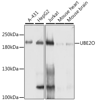 Lane 1: A431 cell lysates; Lane 2: HepG2 cell lysates; Lane 3: Jurkat cell lysates; Lane 4: Mouse Heart lysates; Lane 5: Mouse Brain lysates probed with UBE2O Polyclonal Antibody, Unconjugated (bs-55219R) at 1:1000 dilution and 4˚C overnight incubation. Followed by conjugated secondary antibody incubation at 1:20000 for 60 min at 37˚C. Lane 1: A431 cell lysates; Lane 2: HepG2 cell lysates; Lane 3: Jurkat cell lysates; Lane 4: Mouse Heart lysates; Lane 5: Mouse Brain lysates probed with UBE2O Polyclonal Antibody, Unconjugated (bs-55219R) at 1:1000 dilution and 4˚C overnight incubation. Followed by conjugated secondary antibody incubation at 1:20000 for 60 min at 37˚C.