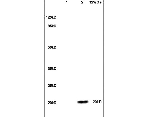 Lane 1: mouse brain lysates Lane 2: human colon carcinoma lysates probed with Anti ESM1 Polyclonal Antibody, Unconjugated (bs-3615R) at 1:200 in 4˚C. Followed by conjugation to secondary antibody (bs-0295G-HRP) at 1:3000 90min in 37˚C. Predicted band 20kD. Observed band size: 20kD