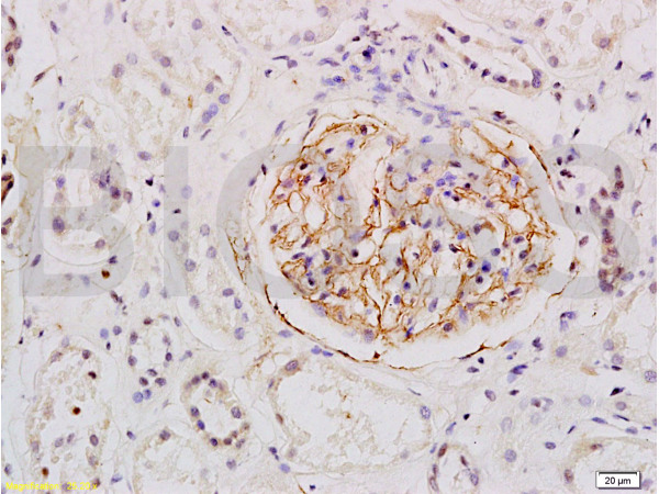 Formalin-fixed and human kidney tissue labeled with Anti-ESM1 Polyclonal Antibody, Unconjugated (bs-3615R) at 1:200 followed by conjugation to the secondary antibody and DAB staining