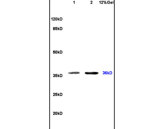 Lane 1: mouse spleen lysates Lane 2: mouse brain lysates probed with Anti SIAH2 Polyclonal Antibody, Unconjugated (bs-3634R) at 1:200 in 4˚C. Followed by conjugation to secondary antibody (bs-0295G-HRP) at 1:3000 90min in 37˚C. Predicted band 36kD. Observed band size: 36kD