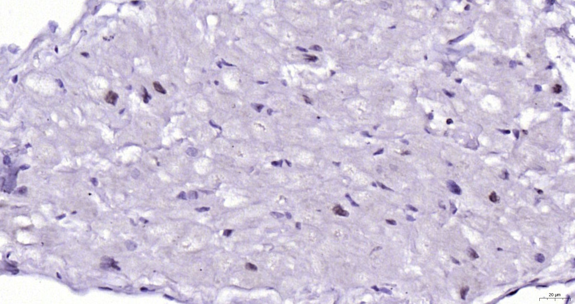 Paraformaldehyde-fixed, paraffin embedded Human heart; Antigen retrieval by boiling in sodium citrate buffer (pH6.0) for 15min; Block endogenous peroxidase by 3% hydrogen peroxide for 20 minutes; Blocking buffer (normal goat serum) at 37°C for 30min; Antibody incubation with Nkx2.5 Polyclonal Antibody, Unconjugated (bs-2054R) at 1:200 overnight at 4°C, DAB staining.