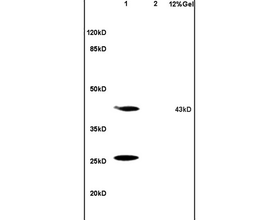 Lane 1: mouse brain lysates Lane 2: mouse kidney lysates probed with Anti HSD17B2 Polyclonal Antibody, Unconjugated (bs-3856R) at 1:200 in 4˚C. Followed by conjugation to secondary antibody (bs-0295G-HRP) at 1:3000 90min in 37˚C. Predicted band 43kD. Observed band size: 43kD