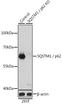 Lane 1: 293T cell lysates; Lane 2: SQSTM1\/p62 knockout (KO) 293T cell lysates probed with SQSTM1\/p62 Polyclonal Antibody, Unconjugated (bs-55207R) at 1:1000 dilution and 4˚C overnight incubation. Followed by conjugated secondary antibody incubation at 1:20000 for 60 min at 37˚C.