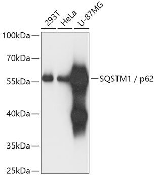 Lane 1: 293T cell lysates; Lane 2: Hela cell lysates; Lane 3: U87-MG cell lysates probed with SQSTM1\/p62 Polyclonal Antibody, Unconjugated (bs-55207R) at 1:1000 dilution and 4˚C overnight incubation. Followed by conjugated secondary antibody incubation at 1:20000 for 60 min at 37˚C.
