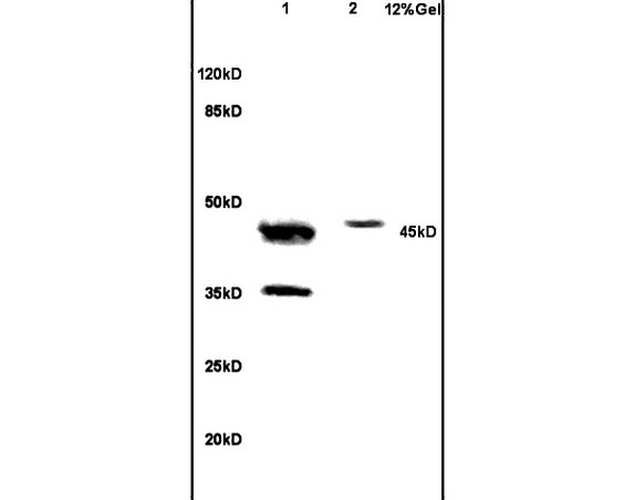 Lane 1: human colon carcinoma lysates Lane 2: mouse brain lysates probed with Anti NCF1/p47 phox Polyclonal Antibody, Unconjugated (bs-3886R) at 1:200 in 4˚C. Followed by conjugation to secondary antibody (bs-0295G-HRP) at 1:3000 90min in 37˚C. Predicted band 45kD. Observed band size: 45kD