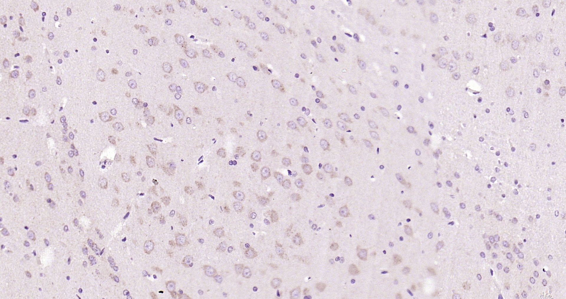 Paraformaldehyde-fixed, paraffin embedded Rat brain; Antigen retrieval by boiling in sodium citrate buffer (pH6.0) for 15min; Block endogenous peroxidase by 3% hydrogen peroxide for 20 minutes; Blocking buffer (normal goat serum) at 37°C for 30min; Antibody incubation with APAF1 Polyclonal Antibody, Unconjugated (bs-0059R) at 1:200 overnight at 4°C, DAB staining.