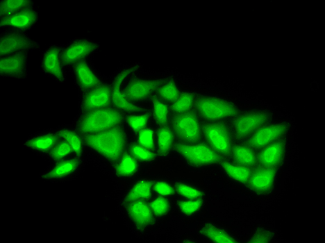 U2-OS cell; 4% Paraformaldehyde-fixed; Triton X-100 at room temperature for 20 min; Blocking buffer (normal goat serum, C-0005) at 37°C for 20 min; Antibody incubation with (POLE3) polyclonal Antibody, Unconjugated (bs-55169R) 1:100, 90 minutes at 37°C; followed by a conjugated Goat Anti-Rabbit IgG antibody at 37°C for 90 minutes.