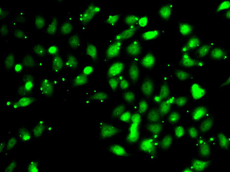 MCF7 cell; 4% Paraformaldehyde-fixed; Triton X-100 at room temperature for 20 min; Blocking buffer (normal goat serum, C-0005) at 37°C for 20 min; Antibody incubation with (XIAP) polyclonal Antibody, Unconjugated (bs-55223R) 1:100, 90 minutes at 37°C; followed by a conjugated Goat Anti-Rabbit IgG antibody at 37°C for 90 minutes, DAPI (blue, C02-04002) was used to stain the cell nuclei.