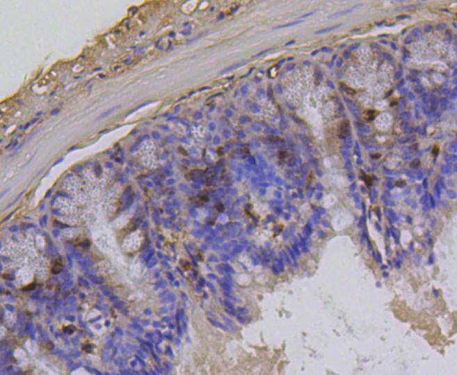Paraformaldehyde-fixed, paraffin embedded Mouse colon; Antigen retrieval by boiling in sodium citrate buffer (pH6.0) for 15min; Block endogenous peroxidase by 3% hydrogen peroxide for 20 minutes; Blocking buffer (normal goat serum) at 37°C for 30min; Antibody incubation with Phospho-Histone H1.3(T17)+Histone H1.4(T17) Monoclonal Antibody, Unconjugated (bsm-54480R) at 1:200 for 30 minutes at room temperature, DAB staining. Paraformaldehyde-fixed, paraffin embedded Mouse colon; Antigen retrieval by boiling in sodium citrate buffer (pH6.0) for 15min; Block endogenous peroxidase by 3% hydrogen peroxide for 20 minutes; Blocking buffer (normal goat serum) at 37°C for 30min; Antibody incubation with Phospho-Histone H1.3(T17)+Histone H1.4(T17) Monoclonal Antibody, Unconjugated (bsm-54480R) at 1:200 for 30 minutes at room temperature, DAB staining.