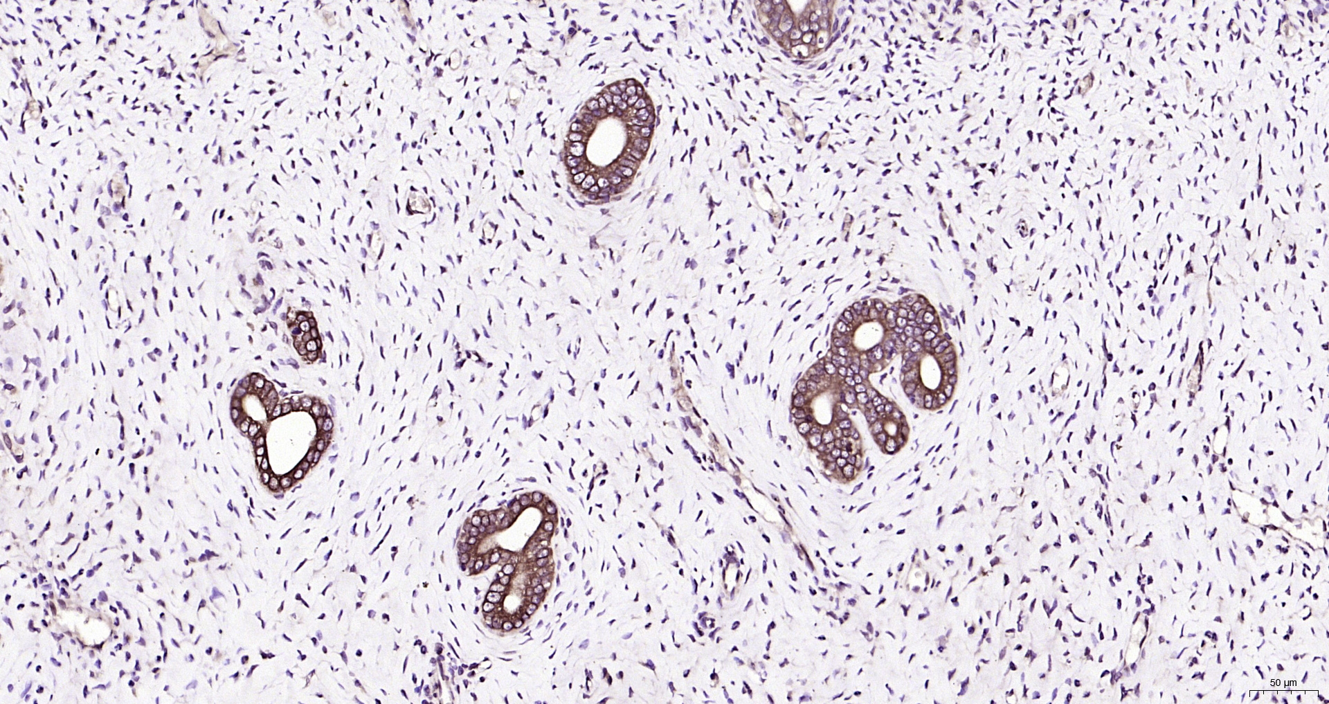 Paraformaldehyde-fixed, paraffin embedded Rat uterus; Antigen retrieval by boiling in sodium citrate buffer (pH6.0) for 15min; Block endogenous peroxidase by 3% hydrogen peroxide for 20 minutes; Blocking buffer (normal goat serum) at 37°C for 30min; Antibody incubation with IGF 1 Polyclonal Antibody, Unconjugated (bs-0014R) at 1:200 overnight at 4°C, DAB staining.