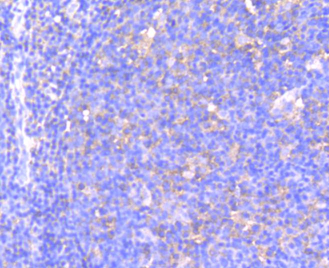 Paraformaldehyde-fixed, paraffin embedded Human tonsil; Antigen retrieval by boiling in sodium citrate buffer (pH6.0) for 15min; Block endogenous peroxidase by 3% hydrogen peroxide for 20 minutes; Blocking buffer (normal goat serum) at 37°C for 30min; Antibody incubation with Phospho-MEK1(S218/S222) Monoclonal Antibody, Unconjugated (bsm-54527R) at 1:50 for 30 minutes at room temperature, DAB staining.