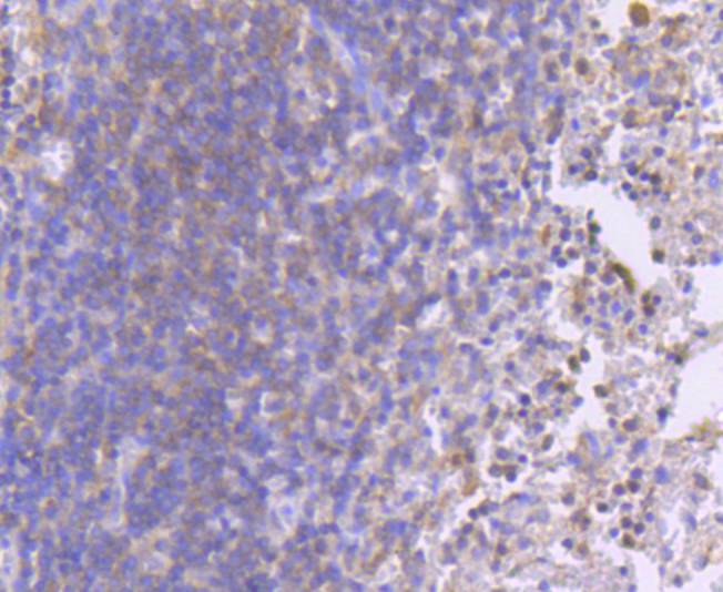 Paraformaldehyde-fixed, paraffin embedded Human spleen; Antigen retrieval by boiling in sodium citrate buffer (pH6.0) for 15min; Block endogenous peroxidase by 3% hydrogen peroxide for 20 minutes; Blocking buffer (normal goat serum) at 37°C for 30min; Antibody incubation with Phospho-MEK1(S218/S222) Monoclonal Antibody, Unconjugated (bsm-54527R) at 1:50 for 30 minutes at room temperature, DAB staining.