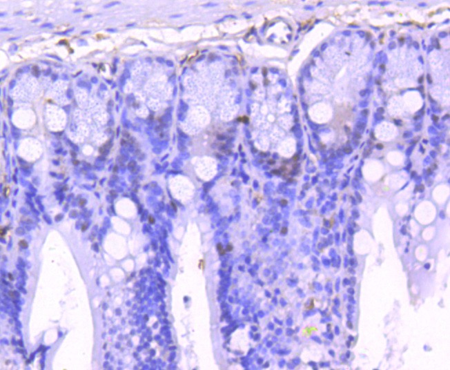 Paraformaldehyde-fixed, paraffin embedded Mouse colon; Antigen retrieval by boiling in sodium citrate buffer (pH6.0) for 15min; Block endogenous peroxidase by 3% hydrogen peroxide for 20 minutes; Blocking buffer (normal goat serum) at 37°C for 30min; Antibody incubation with Phospho-STAT1(S727) Monoclonal Antibody, Unconjugated (bsm-54561R) at 1:50 for 30 minutes at room temperature, DAB staining.