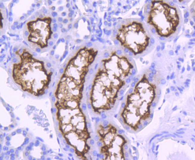 Paraformaldehyde-fixed, paraffin embedded Human kidney; Antigen retrieval by boiling in sodium citrate buffer (pH6.0) for 15min; Block endogenous peroxidase by 3% hydrogen peroxide for 20 minutes; Blocking buffer (normal goat serum) at 37°C for 30min; Antibody incubation with ACE2 Monoclonal Antibody, Unconjugated (bsm-54571R) at 1:50 for 30 minutes at room temperature, DAB staining.
