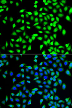 A549 cell; 4% Paraformaldehyde-fixed; Triton X-100 at room temperature for 20 min; Blocking buffer (normal goat serum, C-0005) at 37°C for 20 min; Antibody incubation with (SGTA) polyclonal Antibody, Unconjugated (bs-55197R) 1:100, 90 minutes at 37°C; followed by a conjugated Goat Anti-Rabbit IgG antibody at 37°C for 90 minutes, DAPI (blue, C02-04002) was used to stain the cell nuclei.