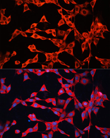 NIH/3T3 cell; 4% Paraformaldehyde-fixed; Triton X-100 at room temperature for 20 min; Blocking buffer (normal goat serum, C-0005) at 37°C for 20 min; Antibody incubation with (GDI2) polyclonal Antibody, Unconjugated (bs-55083R) 1:100, 90 minutes at 37°C; followed by a conjugated Goat Anti-Rabbit IgG antibody at 37°C for 90 minutes, DAPI (blue, C02-04002) was used to stain the cell nuclei.