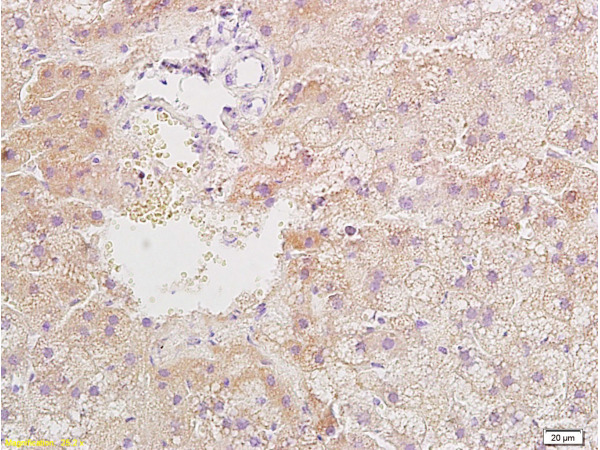 Formalin-fixed and paraffin embedded rat liver tissue with Anti-Resistin Polyclonal Antibody, Unconjugated (bs-0795R) at 1:400, followed by conjugation to the secondary antibody and DAB staining\n