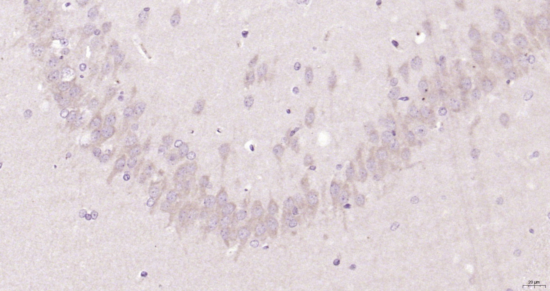 Paraformaldehyde-fixed, paraffin embedded Rat brain; Antigen retrieval by boiling in sodium citrate buffer (pH6.0) for 15min; Block endogenous peroxidase by 3% hydrogen peroxide for 20 minutes; Blocking buffer (normal goat serum) at 37°C for 30min; Antibody incubation with Sept5 Polyclonal Antibody, Unconjugated (bs-6905R) at 1:200 overnight at 4°C, DAB staining.