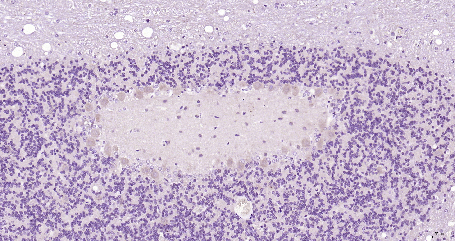 Paraformaldehyde-fixed, paraffin embedded Rat cerebellum; Antigen retrieval by boiling in sodium citrate buffer (pH6.0) for 15min; Block endogenous peroxidase by 3% hydrogen peroxide for 20 minutes; Blocking buffer (normal goat serum) at 37°C for 30min; Antibody incubation with Sept5 Polyclonal Antibody, Unconjugated (bs-6905R) at 1:200 overnight at 4°C, DAB staining.