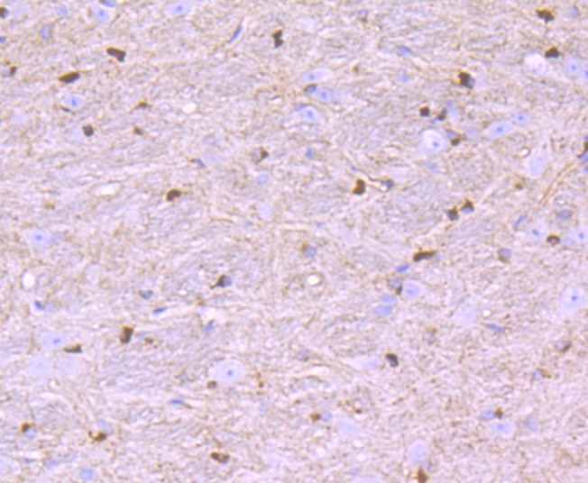 Paraformaldehyde-fixed, paraffin embedded Mouse brain; Antigen retrieval by boiling in sodium citrate buffer (pH6.0) for 15min; Block endogenous peroxidase by 3% hydrogen peroxide for 20 minutes; Blocking buffer (normal goat serum) at 37°C for 30min; Antibody incubation with Nogo Monoclonal Antibody, Unconjugated (bsm-54643R) at 1:200 for 30 minutes at room temperature, DAB staining.