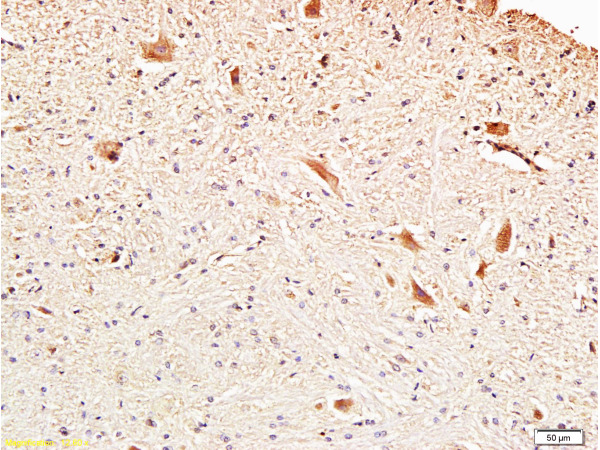 Formalin-fixed and paraffin embedded rat brainstem with Anti-Fascin1 Polyclonal Antibody, Unconjugated (bs-0796R) at 1:300, followed by conjugation to the secondary antibody and DAB staining