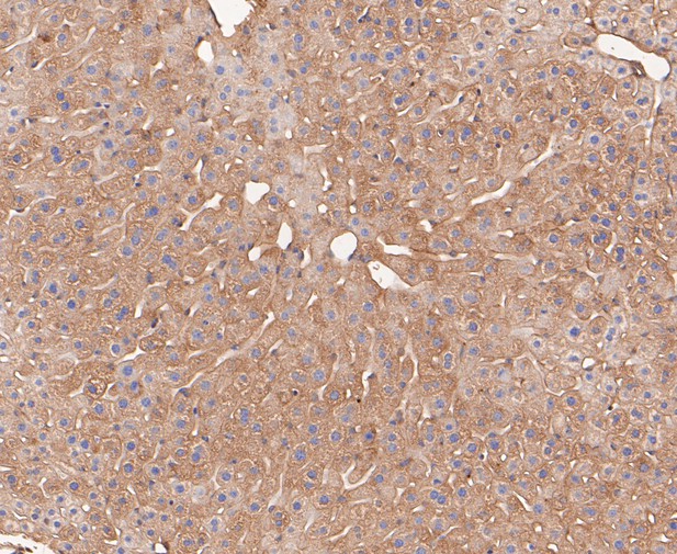 Paraformaldehyde-fixed, paraffin embedded Mouse liver; Antigen retrieval by boiling in sodium citrate buffer (pH6.0) for 15min; Block endogenous peroxidase by 3% hydrogen peroxide for 20 minutes; Blocking buffer (normal goat serum) at 37°C for 30min; Antibody incubation with Calpain small subunit 1 Monoclonal Antibody, Unconjugated (bsm-54658R) at 1:50 for 30 minutes at room temperature, DAB staining. Paraformaldehyde-fixed, paraffin embedded Mouse liver; Antigen retrieval by boiling in sodium citrate buffer (pH6.0) for 15min; Block endogenous peroxidase by 3% hydrogen peroxide for 20 minutes; Blocking buffer (normal goat serum) at 37°C for 30min; Antibody incubation with Calpain small subunit 1 Monoclonal Antibody, Unconjugated (bsm-54658R) at 1:50 for 30 minutes at room temperature, DAB staining.