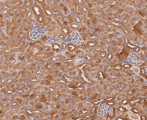 Paraformaldehyde-fixed, paraffin embedded Mouse kidney; Antigen retrieval by boiling in sodium citrate buffer (pH6.0) for 15min; Block endogenous peroxidase by 3% hydrogen peroxide for 20 minutes; Blocking buffer (normal goat serum) at 37°C for 30min; Antibody incubation with Calpain small subunit 1 Monoclonal Antibody, Unconjugated (bsm-54658R) at 1:50 for 30 minutes at room temperature, DAB staining.