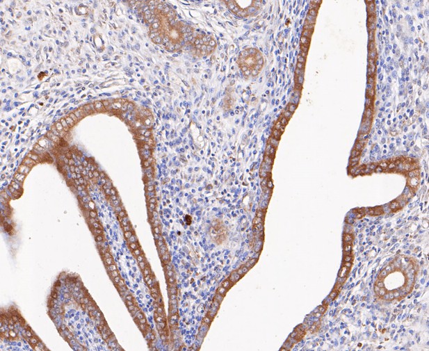 Paraformaldehyde-fixed, paraffin embedded Rat uterus; Antigen retrieval by boiling in sodium citrate buffer (pH6.0) for 15min; Block endogenous peroxidase by 3% hydrogen peroxide for 20 minutes; Blocking buffer (normal goat serum) at 37°C for 30min; Antibody incubation with Calpain small subunit 1 Monoclonal Antibody, Unconjugated (bsm-54658R) at 1:200 for 30 minutes at room temperature, DAB staining.