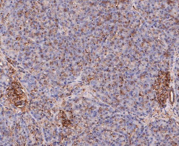 Paraformaldehyde-fixed, paraffin embedded Human pancreas; Antigen retrieval by boiling in sodium citrate buffer (pH6.0) for 15min; Block endogenous peroxidase by 3% hydrogen peroxide for 20 minutes; Blocking buffer (normal goat serum) at 37°C for 30min; Antibody incubation with Calpain small subunit 1 Monoclonal Antibody, Unconjugated (bsm-54658R) at 1:50 for 30 minutes at room temperature, DAB staining.