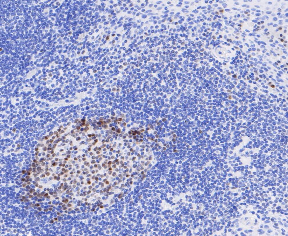Paraformaldehyde-fixed, paraffin embedded Human tonsil; Antigen retrieval by boiling in sodium citrate buffer (pH6.0) for 15min; Block endogenous peroxidase by 3% hydrogen peroxide for 20 minutes; Blocking buffer (normal goat serum) at 37°C for 30min; Antibody incubation with BOB1 Monoclonal Antibody, Unconjugated (bsm-54659R) at 1:200 for 30 minutes at room temperature, DAB staining.