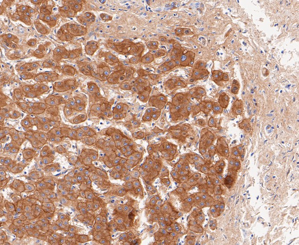 Paraformaldehyde-fixed, paraffin embedded Human liver; Antigen retrieval by boiling in sodium citrate buffer (pH6.0) for 15min; Block endogenous peroxidase by 3% hydrogen peroxide for 20 minutes; Blocking buffer (normal goat serum) at 37°C for 30min; Antibody incubation with SAA4 Monoclonal Antibody, Unconjugated (bsm-54660R) at 1:50 for 30 minutes at room temperature, DAB staining.