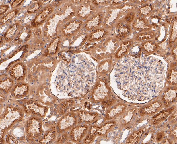 Paraformaldehyde-fixed, paraffin embedded Human kidney; Antigen retrieval by boiling in sodium citrate buffer (pH6.0) for 15min; Block endogenous peroxidase by 3% hydrogen peroxide for 20 minutes; Blocking buffer (normal goat serum) at 37°C for 30min; Antibody incubation with SAA4 Monoclonal Antibody, Unconjugated (bsm-54660R) at 1:50 for 30 minutes at room temperature, DAB staining.