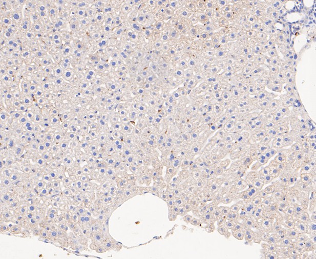 Paraformaldehyde-fixed, paraffin embedded Mouse liver; Antigen retrieval by boiling in sodium citrate buffer (pH6.0) for 15min; Block endogenous peroxidase by 3% hydrogen peroxide for 20 minutes; Blocking buffer (normal goat serum) at 37°C for 30min; Antibody incubation with ACADM Monoclonal Antibody, Unconjugated (bsm-54662R) at 1:200 for 30 minutes at room temperature, DAB staining.