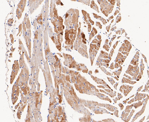 Paraformaldehyde-fixed, paraffin embedded Mouse heart; Antigen retrieval by boiling in sodium citrate buffer (pH6.0) for 15min; Block endogenous peroxidase by 3% hydrogen peroxide for 20 minutes; Blocking buffer (normal goat serum) at 37°C for 30min; Antibody incubation with ACADM Monoclonal Antibody, Unconjugated (bsm-54662R) at 1:200 for 30 minutes at room temperature, DAB staining.