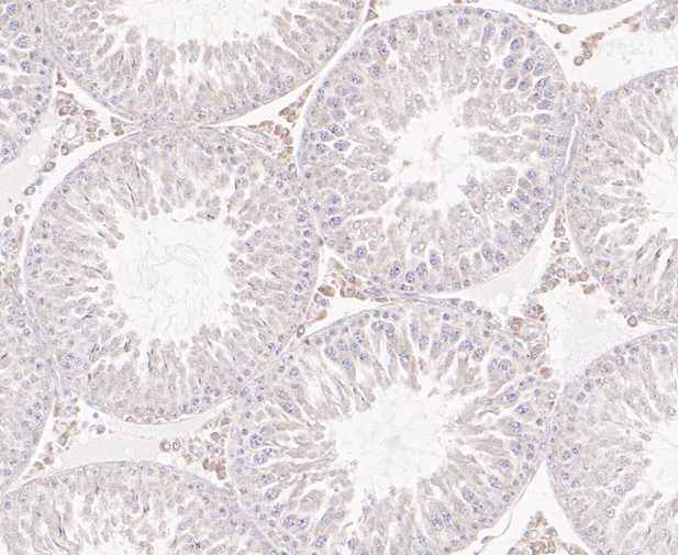 Paraformaldehyde-fixed, paraffin embedded Rat testis; Antigen retrieval by boiling in sodium citrate buffer (pH6.0) for 15min; Block endogenous peroxidase by 3% hydrogen peroxide for 20 minutes; Blocking buffer (normal goat serum) at 37°C for 30min; Antibody incubation with ACADM Monoclonal Antibody, Unconjugated (bsm-54662R) at 1:50 for 30 minutes at room temperature, DAB staining.