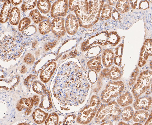 Paraformaldehyde-fixed, paraffin embedded Human kidney; Antigen retrieval by boiling in sodium citrate buffer (pH6.0) for 15min; Block endogenous peroxidase by 3% hydrogen peroxide for 20 minutes; Blocking buffer (normal goat serum) at 37°C for 30min; Antibody incubation with ACADM Monoclonal Antibody, Unconjugated (bsm-54662R) at 1:50 for 30 minutes at room temperature, DAB staining.