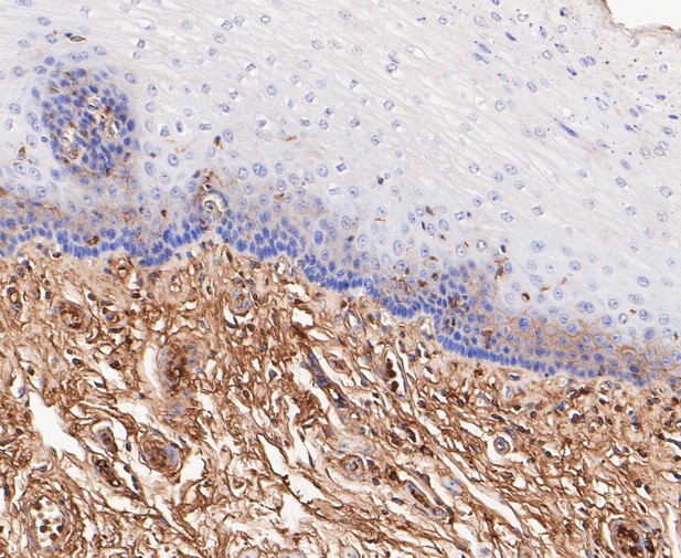 Paraformaldehyde-fixed, paraffin embedded Human esophagus; Antigen retrieval by boiling in sodium citrate buffer (pH6.0) for 15min; Block endogenous peroxidase by 3% hydrogen peroxide for 20 minutes; Blocking buffer (normal goat serum) at 37°C for 30min; Antibody incubation with ACADM Monoclonal Antibody, Unconjugated (bsm-54662R) at 1:50 for 30 minutes at room temperature, DAB staining.