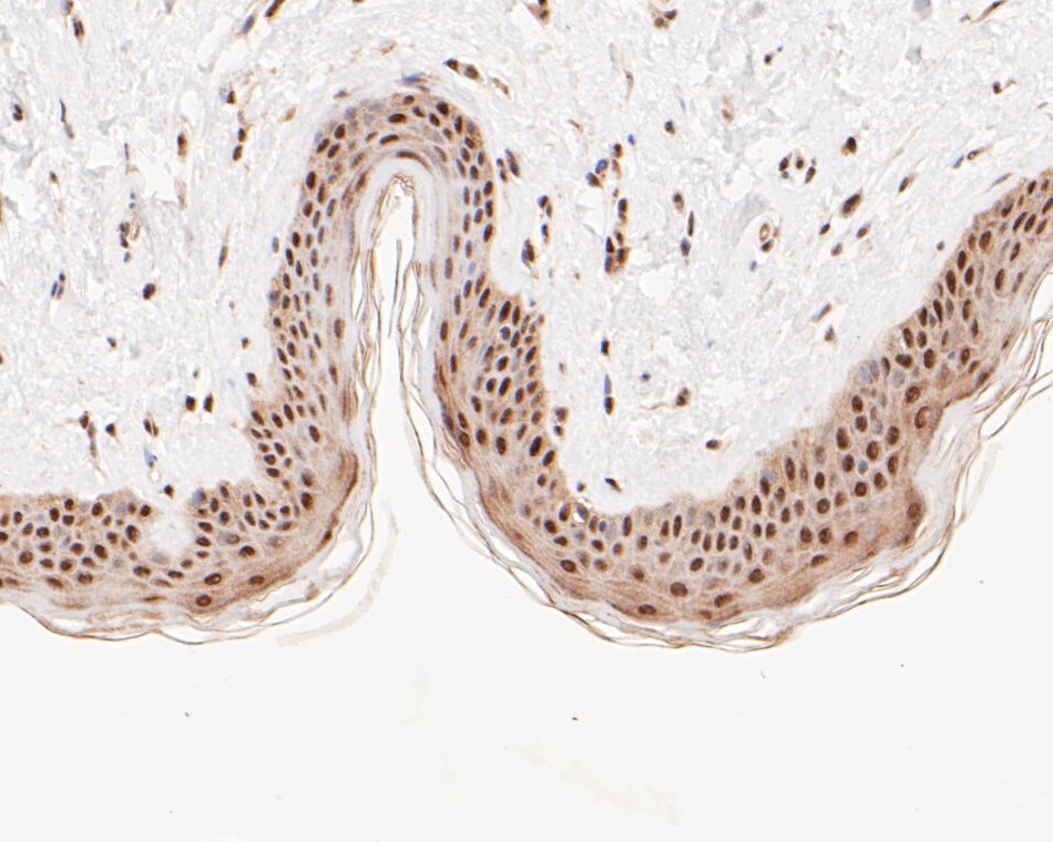 Paraformaldehyde-fixed, paraffin embedded Human skin; Antigen retrieval by boiling in sodium citrate buffer (pH6.0) for 15min; Block endogenous peroxidase by 3% hydrogen peroxide for 20 minutes; Blocking buffer (normal goat serum) at 37°C for 30min; Antibody incubation with HSF2 Monoclonal Antibody, Unconjugated (bsm-54665R) at 1:50 for 30 minutes at room temperature, DAB staining.